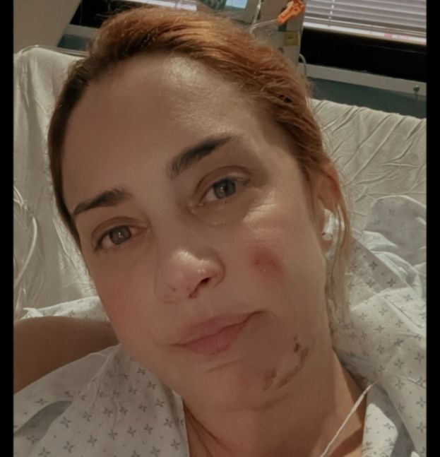 Cómo evoluciona la salud de María Julia Oliván tras quemarse el 25 por ciento de su cuerpo