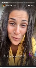 A Ivana Nadal le salió un orzuelo y contó los motivos de su origen