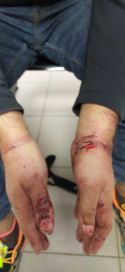 Denuncian brutal agresión policial a quien difundió el sueldo de la esposa de Cotillo