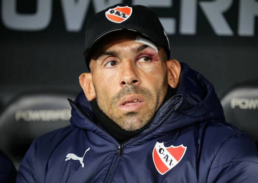 Carlitos Tévez bromeó sobre el accidente doméstico que tuvo en su casa