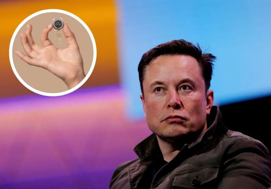 Elon Musk anunció que se implantó el primer chip cerebral en un humano